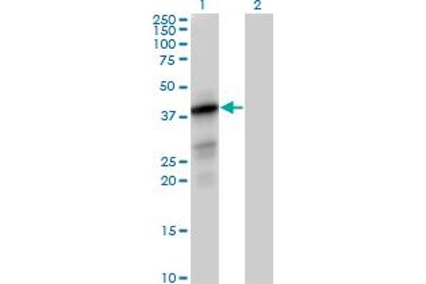 PTPLAD1 antibody  (AA 1-362)