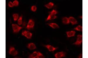 ABIN6267630 staining 293 by IF/ICC. (Acetyl-CoA Carboxylase alpha antibody  (pSer79))