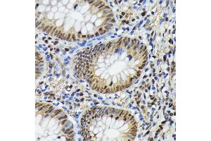 Immunohistochemistry of paraffin-embedded human appendix using Phospho-ERK1-T202 + ERK2-T185 antibody (ABIN7268610) at dilution of 1:100 (40x lens). (ERK1/2 antibody  (pThr185, pThr202))