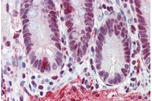Human Small Intestine (formalin-fixed, paraffin-embedded) stained with FUS antibody ABIN462224 followed by biotinylated goat anti-rabbit IgG secondary antibody ABIN481713, alkaline phosphatase-streptavidin and chromogen. (FUS antibody  (N-Term))