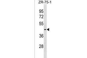 SLC30A10 Antibody (C-term) (ABIN1537148 and ABIN2838295) western blot analysis in ZR-75-1 cell line lysates (35 μg/lane). (SLC30A10 antibody  (AA 331-359))
