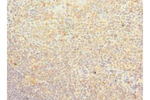 Immunohistochemistry of paraffin-embedded human tonsil tissue using ABIN7163030 at dilution of 1:100 (PSD4 antibody  (AA 1-300))