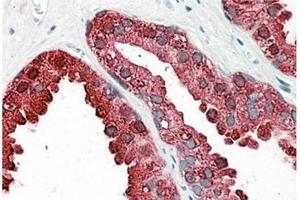 AP31101PU-N ACPP antibody staining of paraffin embedded Human Prostate at 3. (ACPP antibody  (Internal Region))