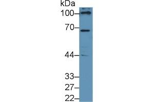Detection of NOX4 in Human 293T cell lysate using Polyclonal Antibody to NADPH Oxidase 4 (NOX4) (NADPH Oxidase 4 antibody  (AA 220-392))