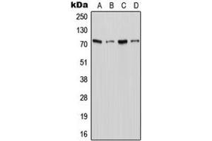 Western blot analysis of XTRP2 expression in Jurkat (A), THP1 (B), Raw264. (SLC6A18 antibody  (C-Term))