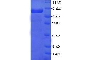SDS-PAGE (SDS) image for Alanine Aminotransferase (ALT) (AA 2-496) protein (His tag) (ABIN5713484)