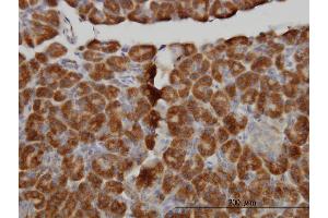 Immunoperoxidase of monoclonal antibody to MTM1 on formalin-fixed paraffin-embedded human pancreas. (MTM1 antibody  (AA 1-100))