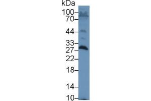 Western blot analysis of Rat Testis lysate, using Rat SAP Antibody (1 µg/ml) and HRP-conjugated Goat Anti-Rabbit antibody ( (APCS antibody  (AA 22-222))
