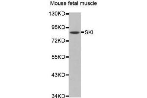 Western Blotting (WB) image for anti-SKI Proto-Oncogene (SKI) antibody (ABIN1682718)
