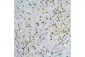 Immunohistochemical analysis of CACNG5 staining in rat brain formalin fixed paraffin embedded tissue section. (CACNG5 antibody)