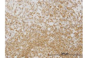 Immunoperoxidase of monoclonal antibody to MPG on formalin-fixed paraffin-embedded human lymph node. (MPG antibody  (AA 1-90))