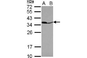 Western Blotting (WB) image for anti-Pyrophosphatase (Inorganic) 1 (PPA1) (AA 92-289) antibody (ABIN1500355)
