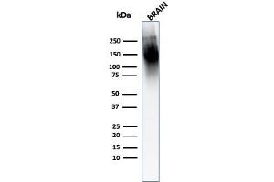 Western Blot Analysis of human Brain tissue lysate using Neurofilament Mouse Monoclonal Antibody (2F11). (NEFH & NEFL antibody)