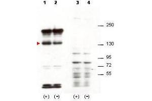 Western blot using  affinity purified anti-Sipa1 antibody shows detection of over-expressed Sipa1 in lysates from mouse 3T3 cells transfected with Sipa1 (lane 1). (SIPA1 antibody)