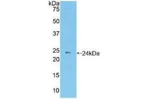 Western blot analysis of recombinant Mouse PCDHb2.