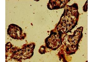 Immunohistochemistry of paraffin-embedded human placenta tissue using ABIN7146907 at dilution of 1:100 (CARD14 antibody  (AA 249-523))
