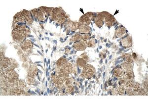 Human Intestine (NCOR1 antibody  (N-Term))