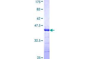 Adamts2 Protein (AA 1112-1210) (GST tag)