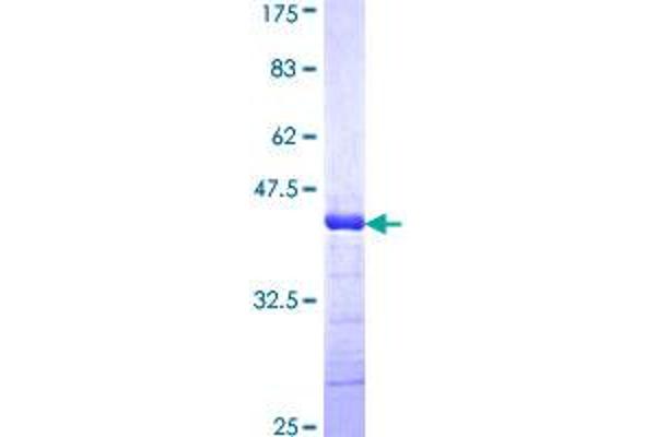 Adamts2 Protein (AA 1112-1210) (GST tag)