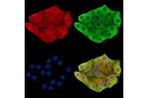 ABIN7095873 and ABIN7099935 staining Hela cells by IF/ICC. (C1orf151 antibody)