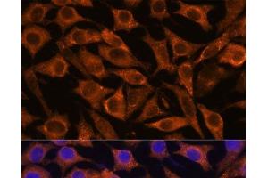 Immunofluorescence analysis of L929 cells using IFITM3 Polyclonal Antibody at dilution of 1:100. (IFITM3 antibody)
