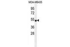 ZNF286B Antibody (N-term) western blot analysis in MDA-MB435 cell line lysates (35 µg/lane). (ZNF286B antibody  (N-Term))