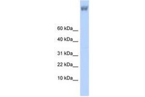 Image no. 1 for anti-Zinc Finger Protein 644 (ZNF644) (AA 1223-1272) antibody (ABIN6740620)