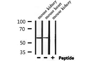 Western blot analysis of extracts from mouse kidney,mouse heart, using BACE Antibody. (BACE1 antibody  (C-Term))