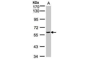 WB Image Sample(30 ug whole cell lysate) A:H1299 7. (YARS antibody  (C-Term))