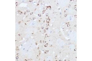 Immunohistochemistry of paraffin-embedded mouse brain using YTHDF3 Rabbit pAb (ABIN6130934, ABIN6150345, ABIN6150346 and ABIN6224441) at dilution of 1:500 (40x lens). (YTHDF3 antibody  (AA 1-275))
