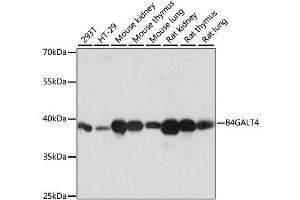 Western blot analysis of extracts of various cell lines, using B4GALT4 antibody (ABIN6291371) at 1:1000 dilution. (B4GALT4 antibody)