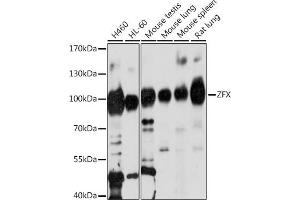 Western blot analysis of extracts of various cell lines, using ZFX antibody (ABIN7271539) at 1:1000 dilution.