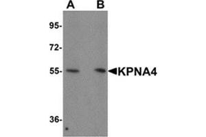 Western blot analysis of KPNA1 in Hela cell lysate with KPNA1 antibody at 1 μg/ml.