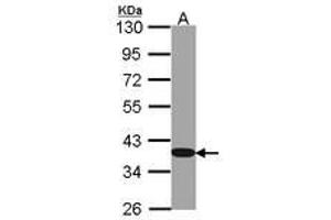 Image no. 1 for anti-Glyceraldehyde-3-Phosphate Dehydrogenase (GAPDH) antibody (ABIN467389) (GAPDH antibody)