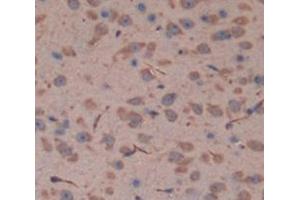 IHC-P analysis of Mouse Tissue, with DAB staining. (Fascin 2 antibody  (AA 308-442))