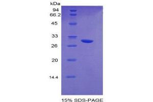 SDS-PAGE (SDS) image for Early Growth Response 2 (EGR2) (AA 150-407) protein (His tag) (ABIN2120976)