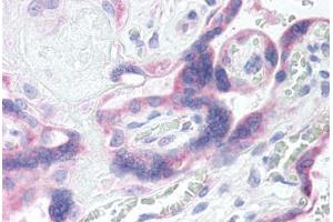 Human Placenta (formalin-fixed, paraffin-embedded) stained with GRK5 antibody ABIN290254 at 20 ug/ml followed by biotinylated goat anti-rabbit IgG secondary antibody ABIN481713, alkaline phosphatase-streptavidin and chromogen. (GRK5 antibody  (AA 350-400))