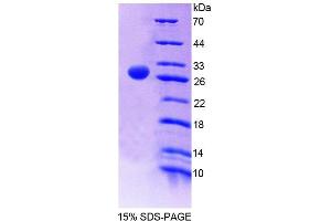 SDS-PAGE (SDS) image for Flavin Containing Monooxygenase 2 (Non-Functional) (FMO2) (AA 116-324) protein (His tag) (ABIN6239109) (FMO2 Protein (AA 116-324) (His tag))