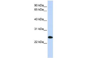 WB Suggested Anti-UBE2K Antibody Titration: 0. (UBE2K antibody  (N-Term))