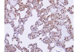 IHC-P Image Immunohistochemical analysis of paraffin-embedded human lung, using XE7, antibody at 1:100 dilution. (SFRS17A antibody  (C-Term))