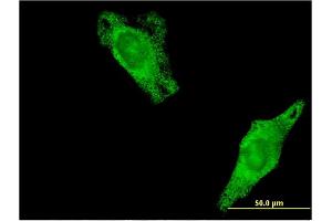 Immunofluorescence of monoclonal antibody to RALA on HeLa cell. (rala antibody  (pSer194))
