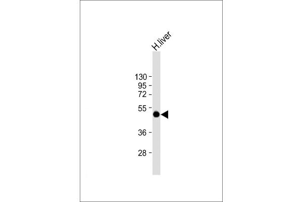 SPHK1 anticorps  (AA 286-315)