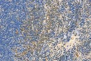 Immunohistochemistry analysis of paraffin-embedded mouse spleen using,BLNK (ABIN7073174) at dilution of 1: 3000 (B-Cell Linker antibody)