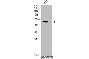Western Blot analysis of 293 cells using Phospho-TPH1 (S58) Polyclonal Antibody (Tryptophan Hydroxylase 1 antibody  (pSer58))