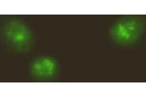 Immunofluorescencechemistry. (NF-kB p65 antibody  (N-Term, NLS Domain))