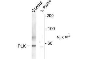 Western blots of rat synaptic membrane showing specific immunolabeling of the ~66 k PLK protein phosphorylated at Thr210 (control). (PLK1 antibody  (pThr210))