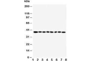 Western blot testing of PPID antibody and Lane 1:  rat brain;  2: rat pancreas;  3: rat liver;  4: Jurkat;  5: Raji;  6: CEM;  7: HL-60;  8: HT1080 cell lysate