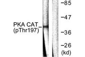 Western blot analysis of extracts from mouse brain, using PKA CAT (Phospho-Thr197) Antibody. (PKA CAT (AA 166-215), (pThr198) antibody)