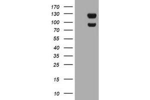Image no. 8 for anti-Ubiquitin Specific Peptidase 7 (Herpes Virus-Associated) (USP7) antibody (ABIN1498594) (USP7 antibody)