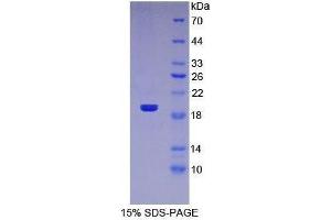 SDS-PAGE (SDS) image for Tumor Necrosis Factor (Ligand) Superfamily, Member 10 (TNFSF10) (AA 114-281) protein (His tag) (ABIN1081080)